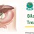 GallStone Treatment, Diagnosis, Causes, Symptoms - ELCE Hospitals